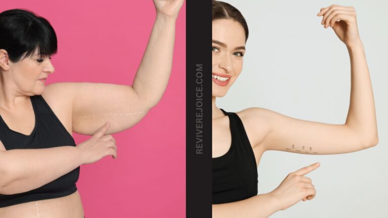 10+ Best Home Exercises To Get Rid Of Flabby Arms-Stop Hiding Your Arms! (Bye-Bye Bat Wings)