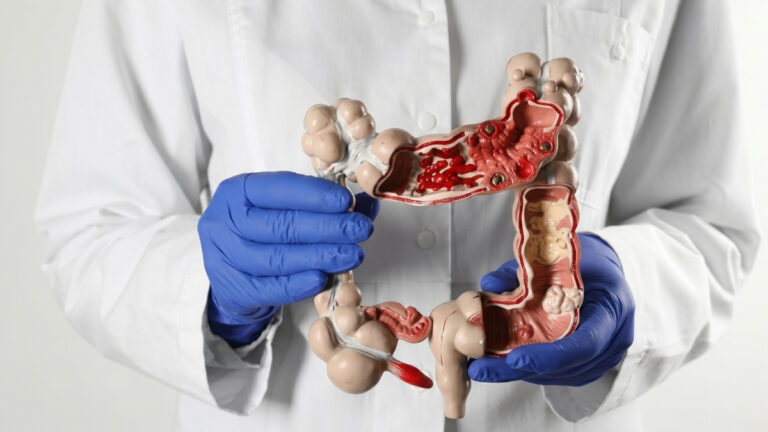 Bathroom Changes? 6 Silent Colon Cancer Signals You MUST Know (And Exactly What to Do Next)