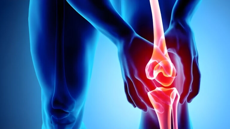 Forget Glucosamine: This Ancient Root Rebuilds Knee Cartilage While You Sleep