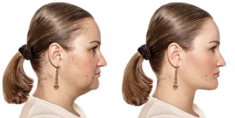 Stop Hiding Your Chin! The 2025 5-Minute Jawline Fix (Works in 10 Days, I Swear!)