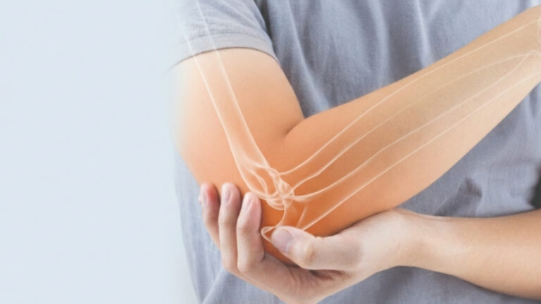 The Calcium Myth: 8 Dairy Alternatives That Make Bones Brittle (Orthopedic Surgeons Warn Women Over 50)