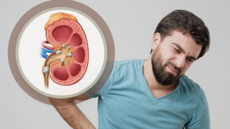 These Common Painkillers Destroying Your Kidneys (And The Natural Alternative)