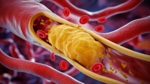 Why Doctors Say These 15 Foods to Avoid Like the Plague Over 30 If You Have High Cholesterol
