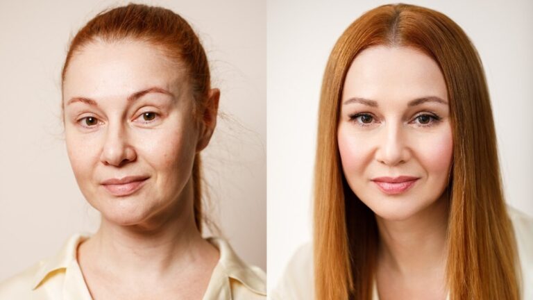 Why Your Skin Thins After 40: 8 Hidden Habits Accelerating Wrinkles (Dermatologists Explain)